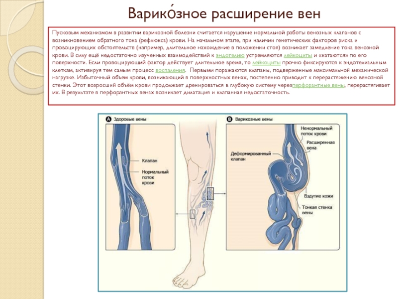 Варикоз корнилова схема