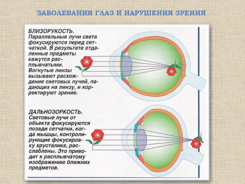 Изображение в глазу какое