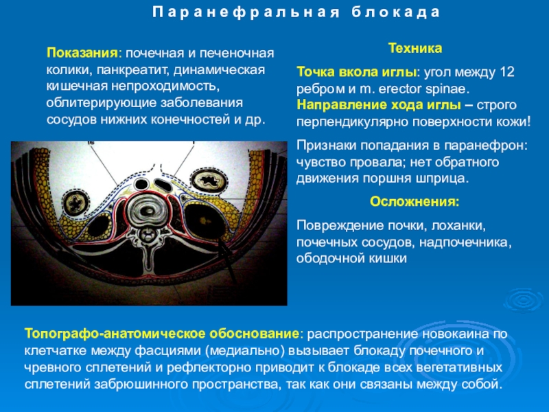 Презентация забрюшинное пространство