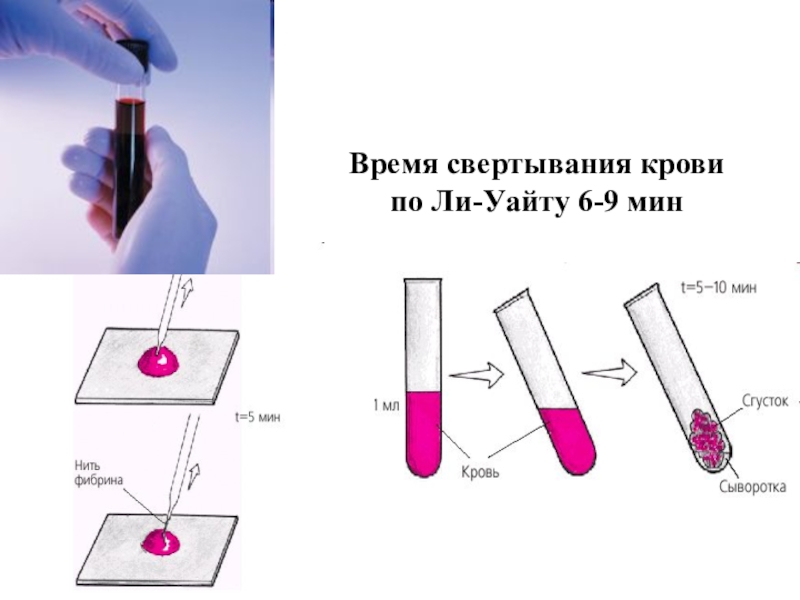 Метод ли. Свертываемость по ли Уайту. Свертывание крови по лиуайту. Время свертывания по ли-Уайту. Определение времени свертывания крови по ли-Уайту.