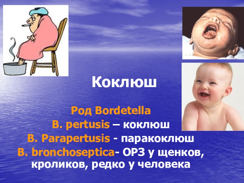 Презентация Коклюш