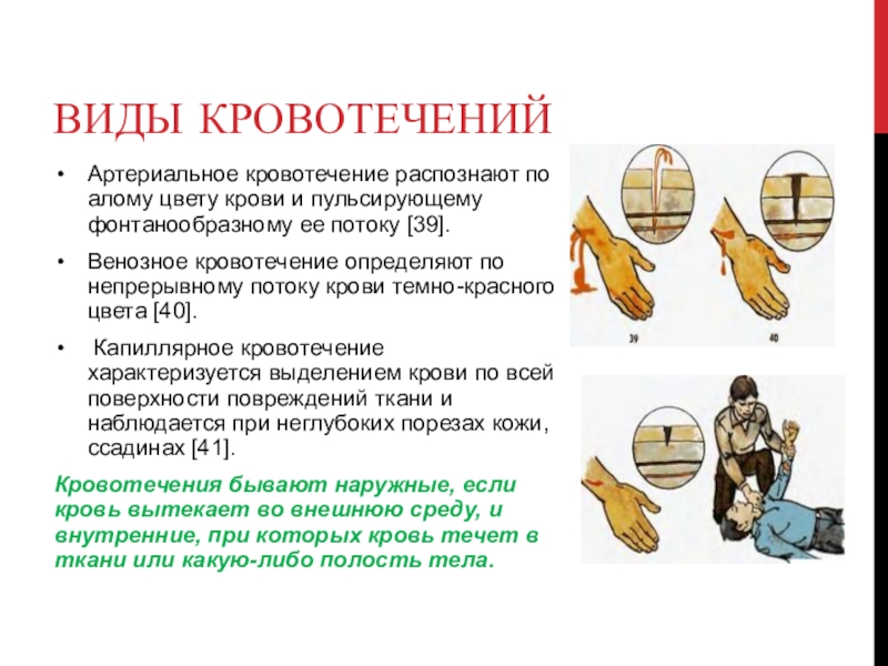 Артериальное от венозного отличия. Различия артериальной и венозной кровотечение. Венозное или артериальное кровотечение. Артериальное кровотечение цвет крови. Отличие венозного и артериального кровотечения.