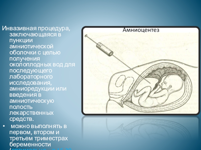 Процедура это. Инвазивные методы исследования плода. Инвазивный метод обследования. Пункция околоплодных вод. Инвазионные процедуры.