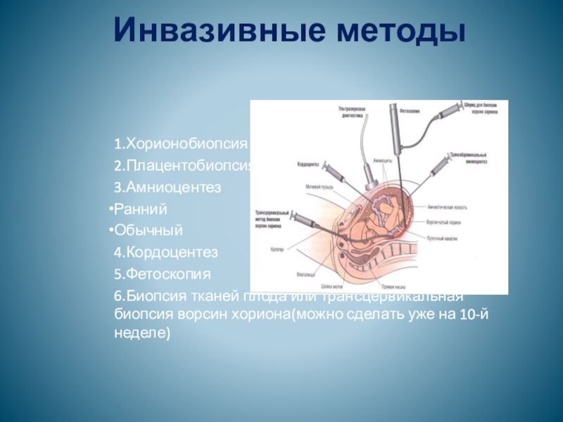 Биопсия ворсин хориона. Трансцервикальная биопсия ворсин хориона. Инвазивные методы диагностики. Инвазивная пренатальная диагностика. Биопсия хориона амниоцентез кордоцентез.