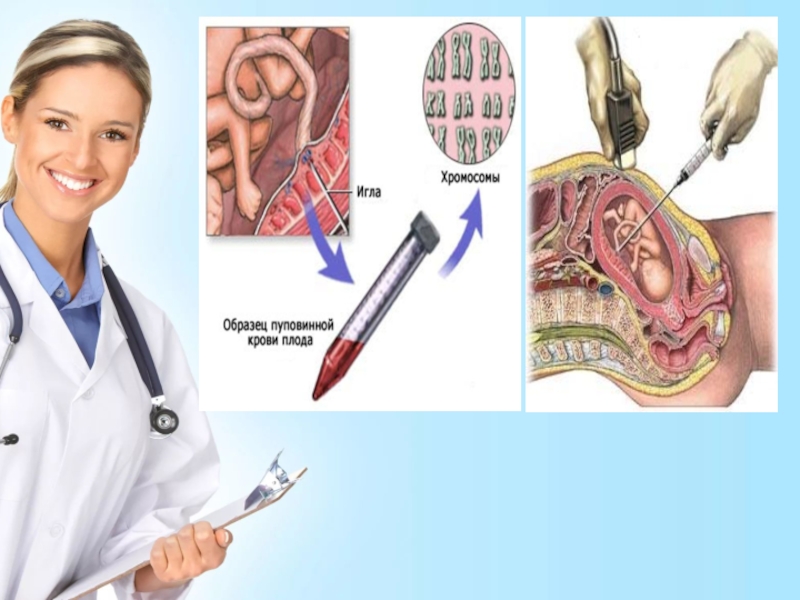 Инвазивная диагностика при беременности