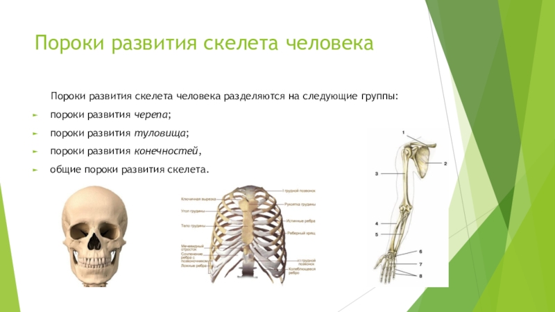 Развитие скелета. Пороки развития скелета. Пороки развития осевого скелета. Аномалии развития скелета человека. Врожденные пороки развития скелета человека.