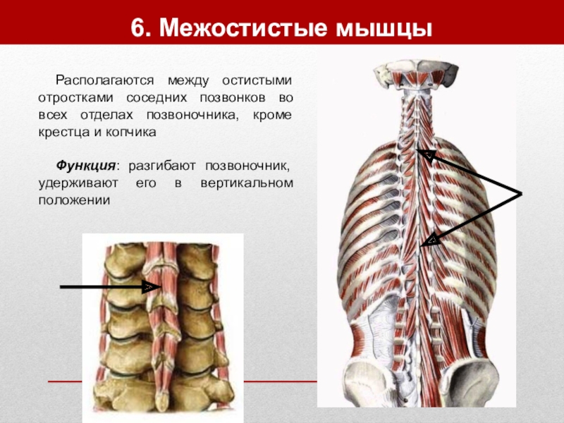 Остистая мышца. Межостистые и межпоперечные. Межостистые мышцы спины. Межостистые мышцы функции. Межостистые мышцы шеи.