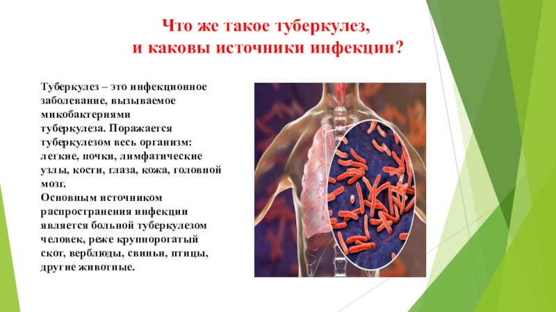 Презентация про туберкулез. Туберкулез у детей презентация. Туберкулез это инфекционное заболевание вызываемое микобактериями. Туберкулез картинки для презентации.