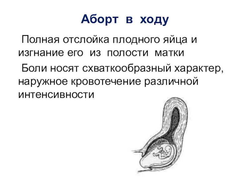 Болит матка после туалета