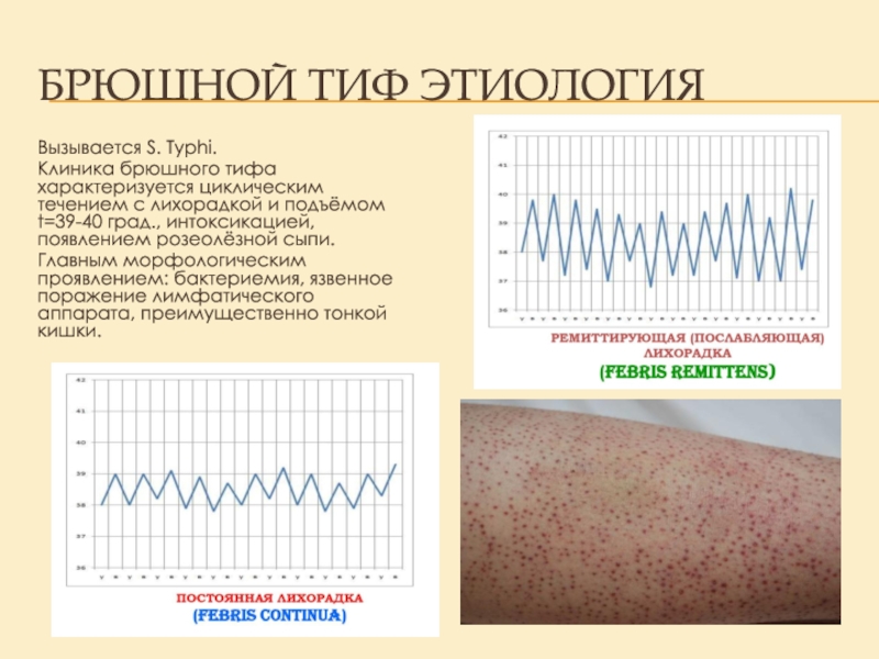 Болезнь брюшной