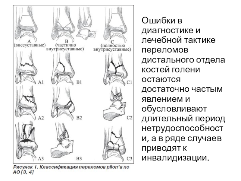 Закрытый перелом голеностопного сустава карта вызова смп