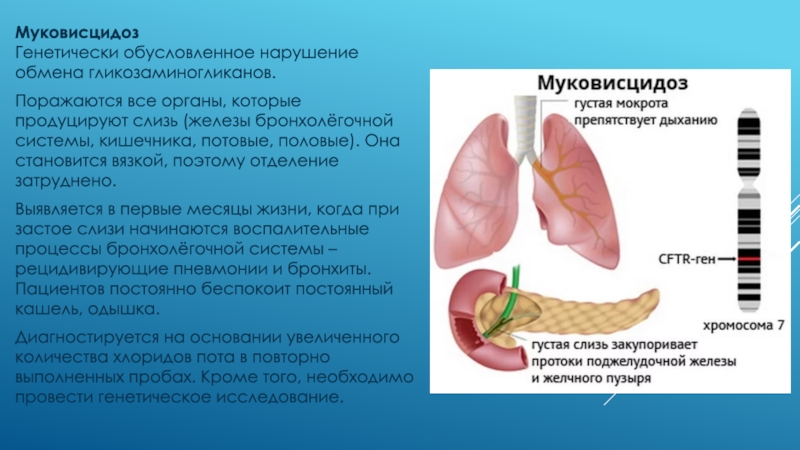 В одной европейской популяции муковисцидоз. Муковисцидоз поджелудочной железы. Муковисцидоз презентация.