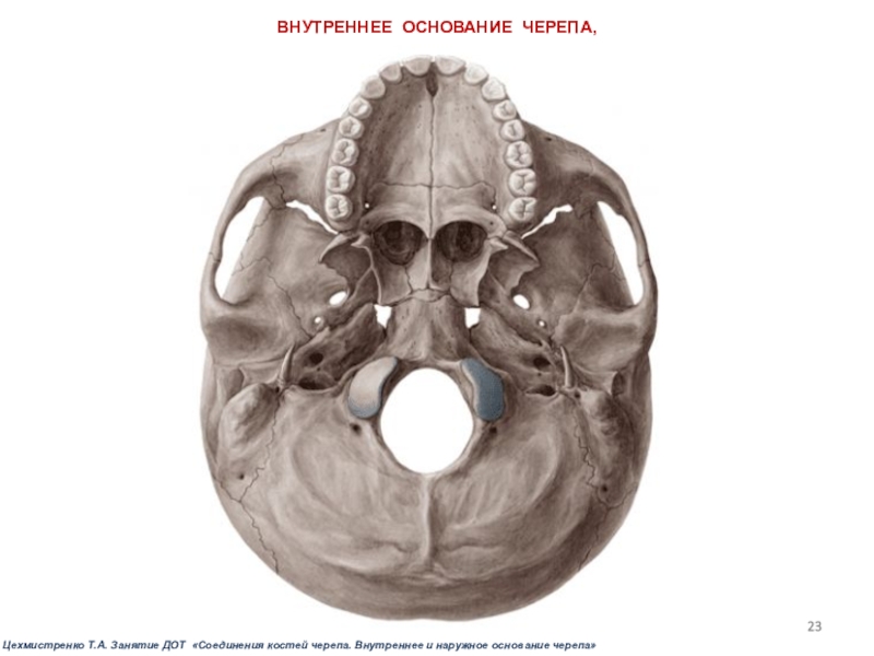 Основание черепа картинка