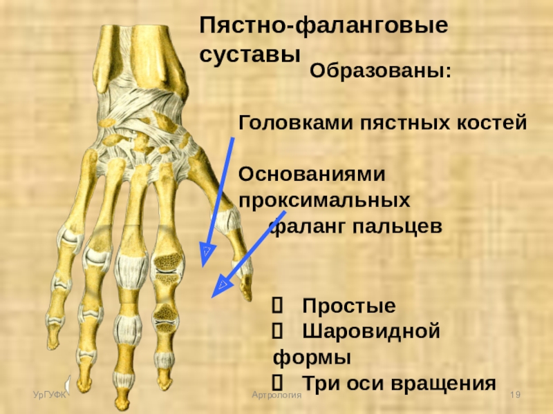 Фаланги пальца тип соединения. Подвывих 1 пястно-фалангового кости. 2 Пястно фаланговый сустав кисти. Пястно фаланговый сустав кости.