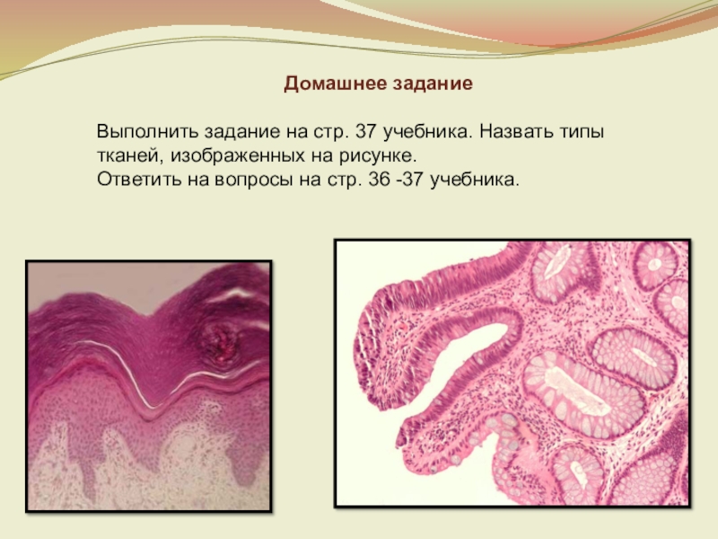 Ткань изображенная на рисунке обладает. Назовите ткань, изображённую на рисунке. Биология 6 выполните задания ткани животных.