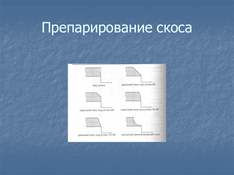 Скос. Скос эмали. Формирование скоса эмали. Презентация принципы препарирование. Методы создания скоса эмали.