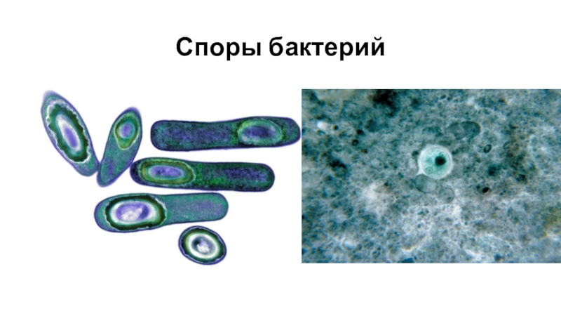 Сколько живут споры. Спора бактерии. Споры бактерий. Спор бактерий. Спора бактерии под микроскопом.