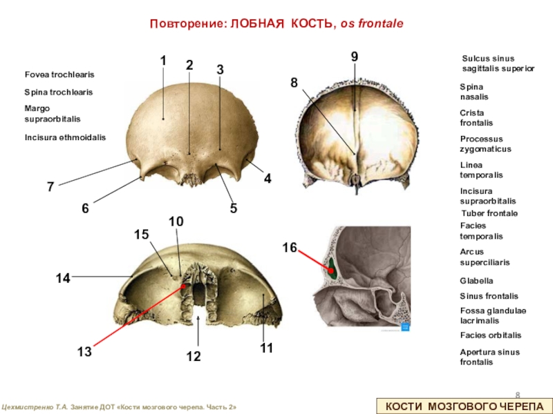 Мозговой отдел черепа лобная кость. Строение лобной кости вид снизу. Incisura frontalis и supraorbitalis.