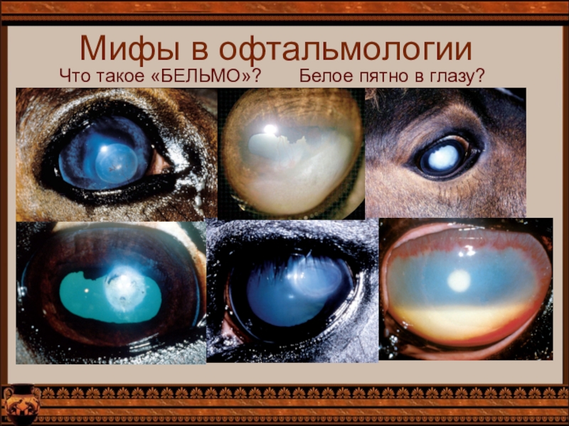 Мифы в офтальмологииЧто такое «БЕЛЬМО»?    Белое пятно в глазу?
