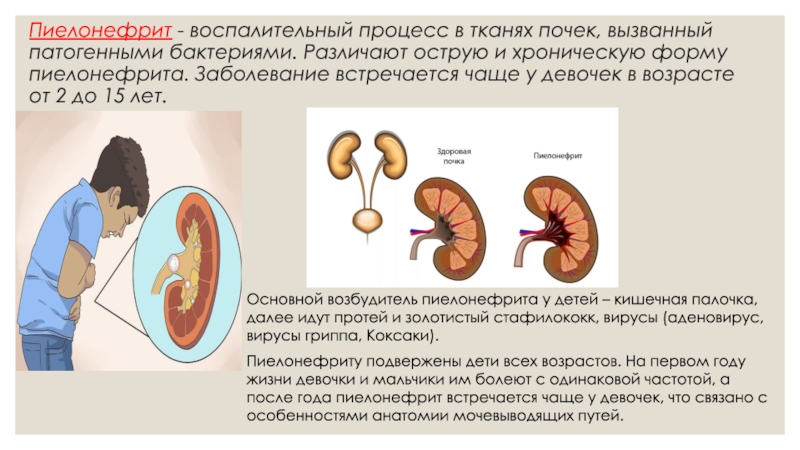 Пиелонефрит у детей. Пиелонефрит симптомы у детей 7 лет. Пиелонефрит симптомы у детей 4 года. Симптомы пиелонефрита у детей до 2 лет. Презентация на тему пиелонефрит у детей.