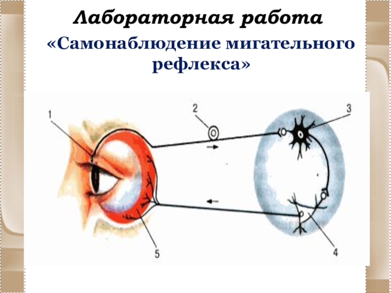 Рисунок зрительного рефлекса