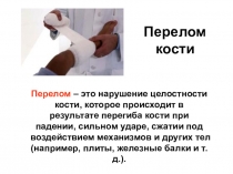Перелом кости