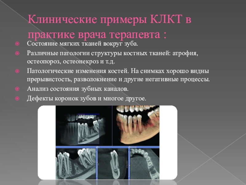 Кт в стоматологии презентация