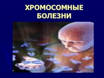 ХРОМОСОМНЫЕ БОЛЕЗНИ