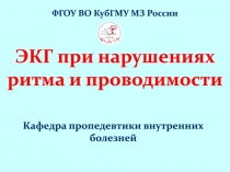 ЭКГ при нарушениях ритма и проводимости