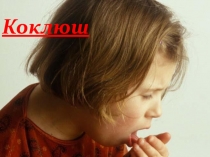 Коклюш