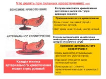 Что делать при сильных кровотечениях (326)