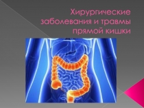 Хирургические заболевания и травмы прямой кишки