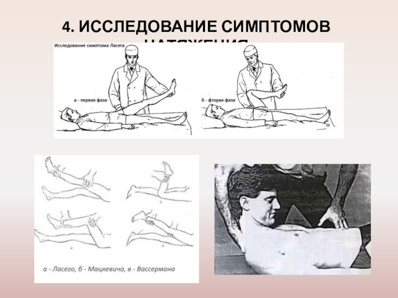 4 исследование. Симптом натяжения Ласега. Симптом натяжения Вассермана и Мацкевича. Симптомы натяжения у животных.