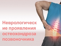 Неврологические проявления остеохондроза позвоночника