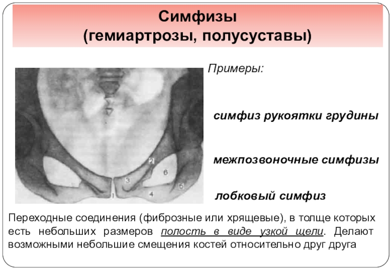 Симфиз это в анатомии. Симфизы примеры. Симфиз рукоятки грудины. Лобковый симфиз. Лобковый симфиз соединение.