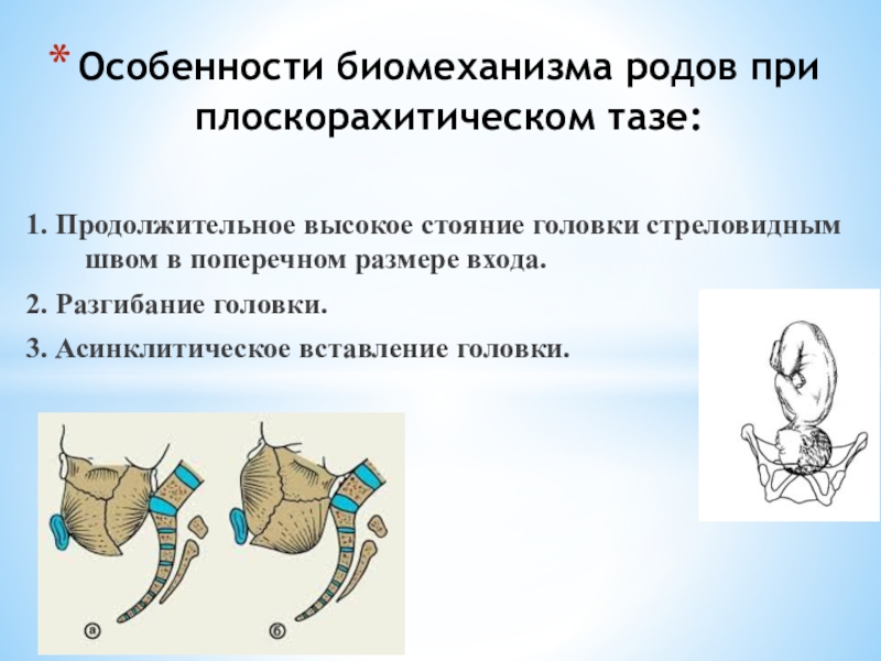 Аномалии таза презентация