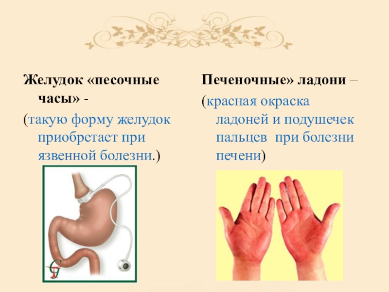 Часы желудка. Медицинские фразеологизмы. Медицинские фразы.