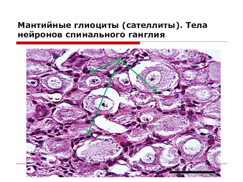 Спинальный ганглий гистология рисунок