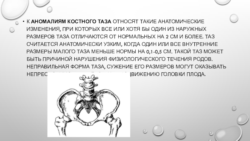 Презентация аномалии костного таза