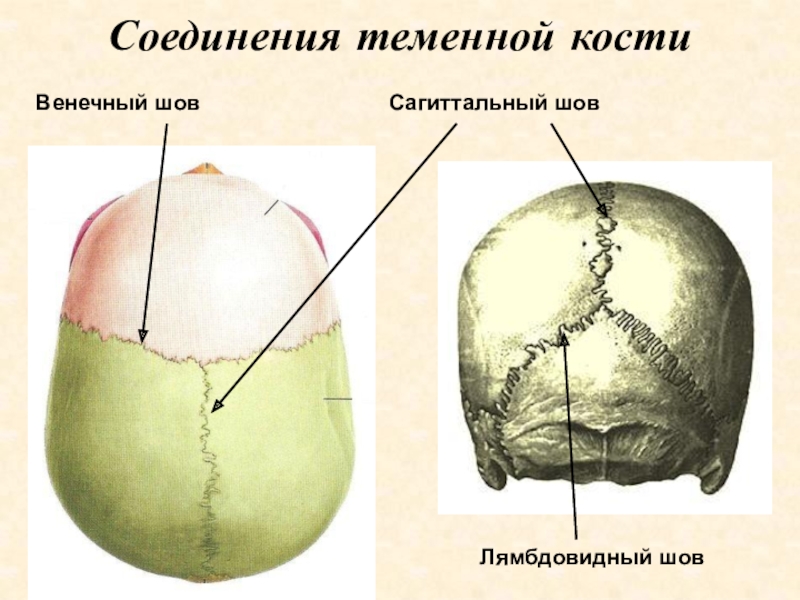Шов между теменными костями. Венечный шов черепа анатомия. Сагиттальный шов черепа. Швы свода черепа анатомия. Сагиттальный и венечный шов.