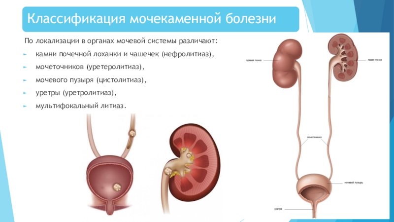 Мочеточник у мужчин