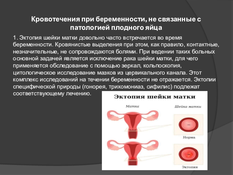 Маточное кровотечение при беременности карта вызова