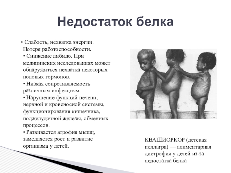 Снижение либидо гормоны. Недостаток белка в организме. Дефицит белка. Белковая недостаточность. Дефицит белка симптомы.