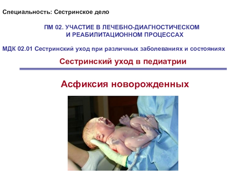 Асфиксия новорожденных
ПМ 02. УЧАСТИЕ В ЛЕЧЕБНО-ДИАГНОСТИЧЕСКОМ И