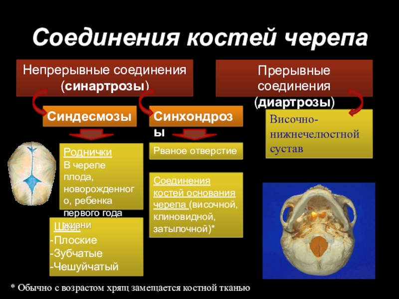 Таблица соединений кости. Непрерывные соединения костей черепа. Тип соединения костей черепа. Соединения костей черепа синостозы. Соединение костей черепа синхондрозы.