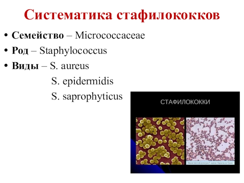 Staphylococcus aureus 5. Стафилококки таксономия. Стафилококки систематика. Систематика стафилококков. Таксономия стафилококков.