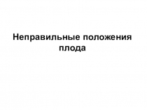 Неправильные положения плода