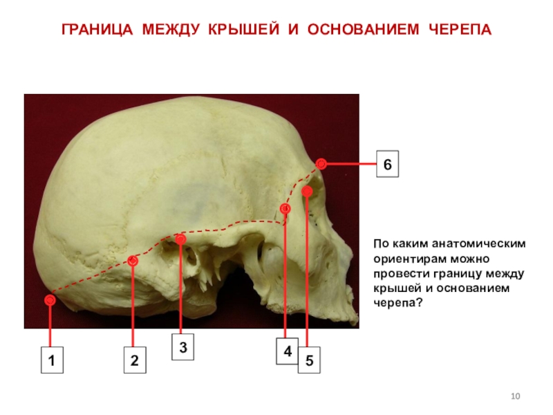 Свод черепа анатомия картинки