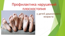 Профилактика нарушений плоскостопия