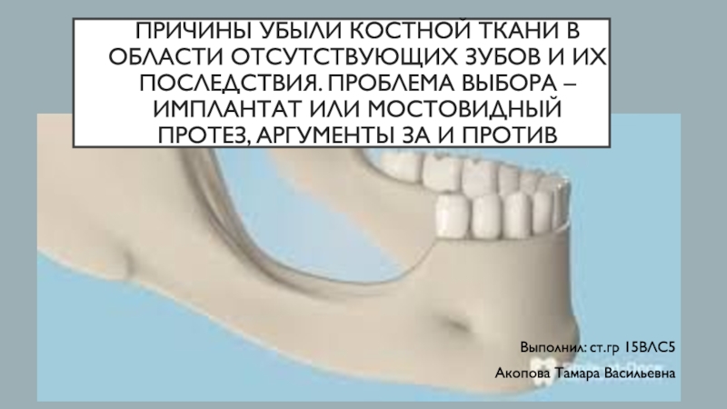 Презентация Причины убыли костной ткани в области отсутствующих зубов и их последствия